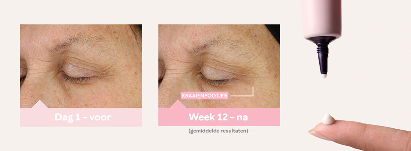 Voor- en na foto's van dag 1 en week 12 die de gemiddelde verbetering van de huid op de kraaienpootjes laten zien na gebruik van TimeWise® Eye Cream, naast een foto van een open oogcrème en een vinger met een klodder van het product erop.